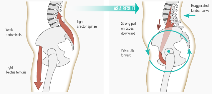 psoas muscle stretch